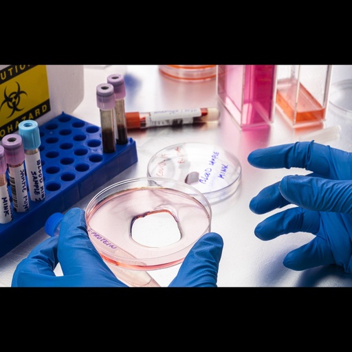 [0980-C14X-1MG] E. Coli Recombinant Human Latent TGF Beta 1 and GARP Complex Protein ''N 6xHis, C 3xStrep''   1 mg