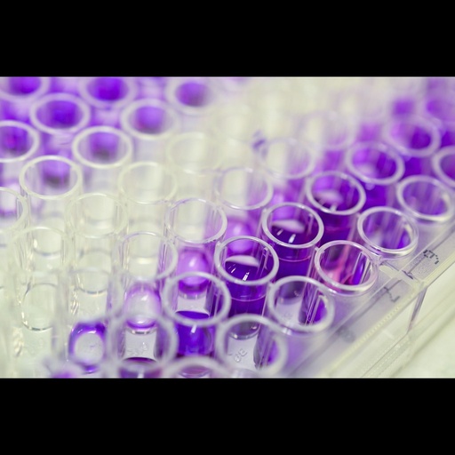 [0002-0801201] Simian Immunodeficiency Virus ''SIV'' p27 Antigen ELISA ''5 X 96 Determinations''